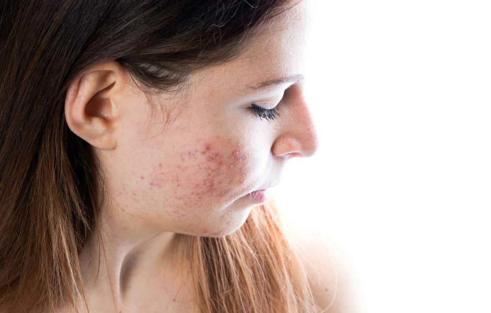 Patches of discolored skin have many possible causes.