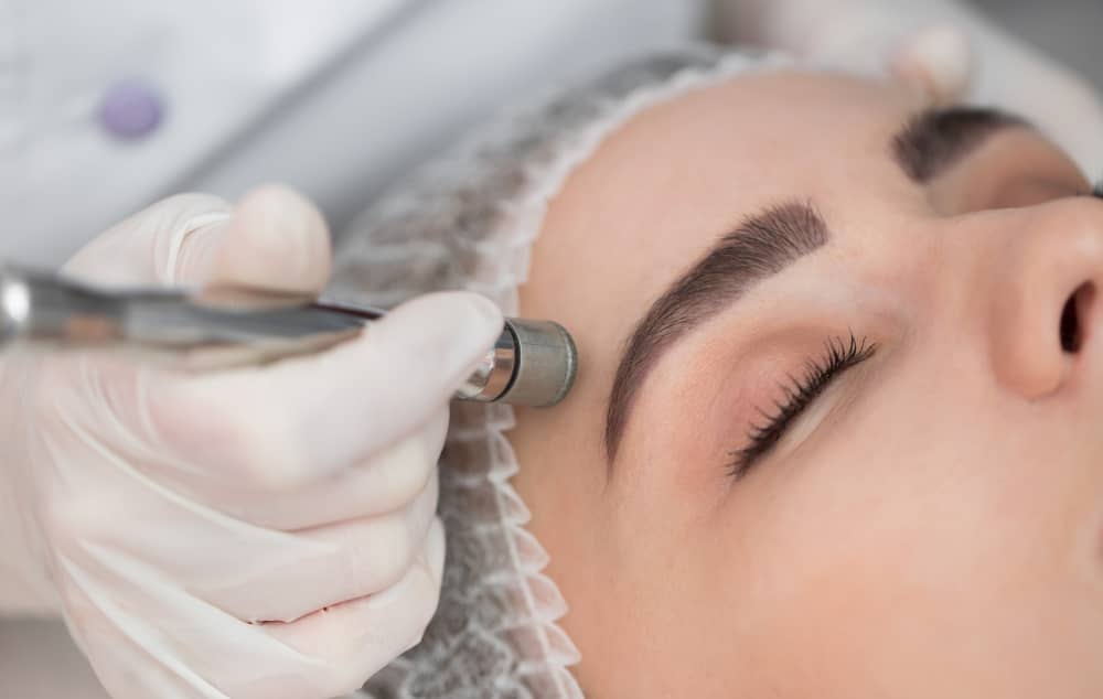 Benefits and Risks With Microdermabrasion